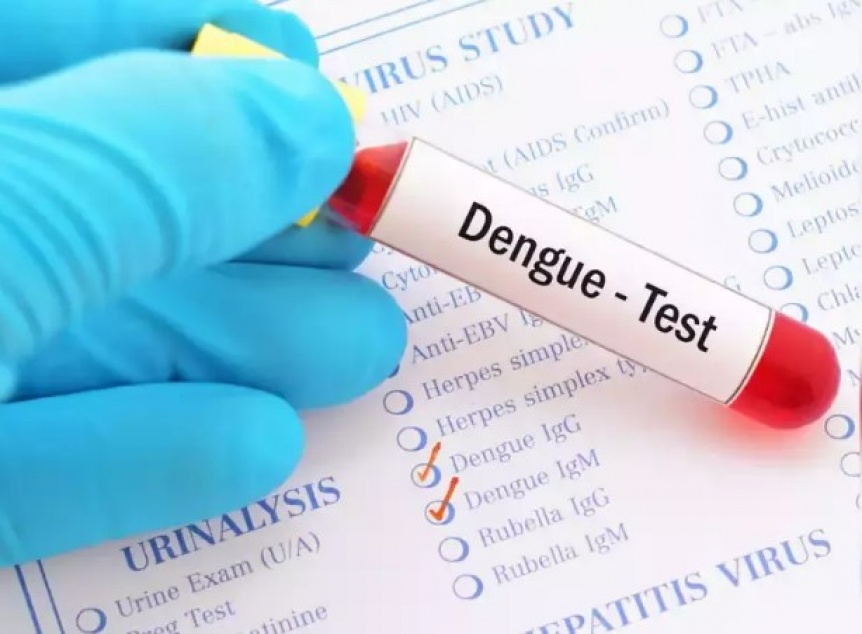 La ANMAT aprob un test nacional para detectar el virus del dengue