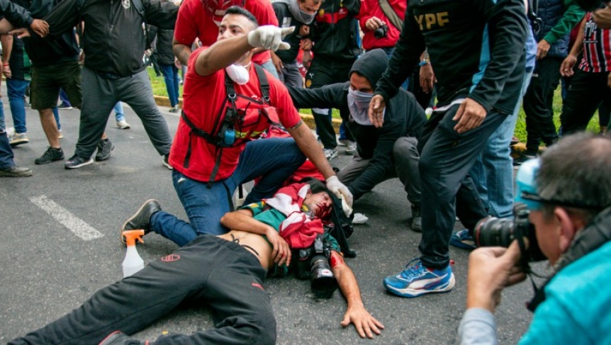 VIDEO | El fotgrafo herido en la marcha fue operado, sigue en estado crtico y piden dadores de sangre